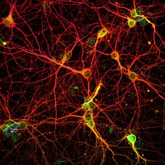 Neurons in a mouse cortex. Neurons in a mouse cortex.