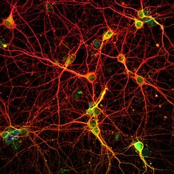 Neuronen in der Großhirnrinde der Maus.