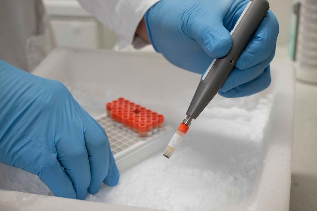 Zwei Hände unten links und oben rechts mit blauen Gummihandschuhen. Die obere Hand hält einen stiftartigen Greifer, an dessen Kopf ein Probenröhrchen mit einer orangen Kappe hängt, das Blutplasma enthält. Die untere Hand hält einen Träger mit weiteren Probenröhrchen.