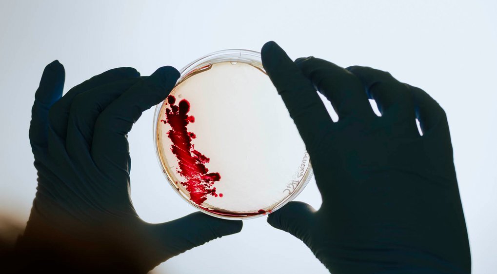 Zwei Hände in schwarzen Handschuhen halten eine durchsichtige Petrischale, die rote Bakterienkulturen enthält, vor einem hellen Hintergrund.
